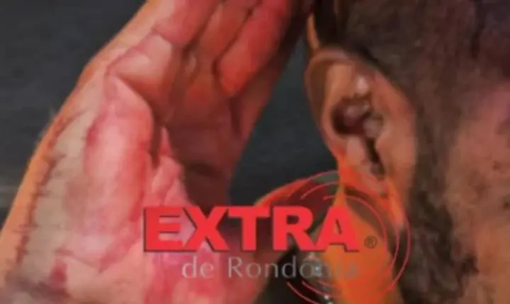 Homem é agredido com taco de sinuca na cabeça no decorrer de discussão em bar de RO